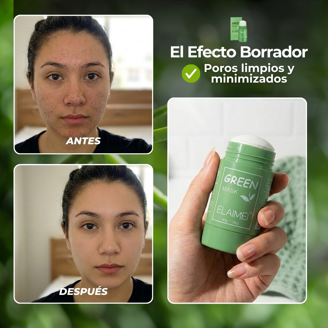 PoroClear™ | Mascarilla Stick que Elimina Puntos Negros (OFERTA 2X1)