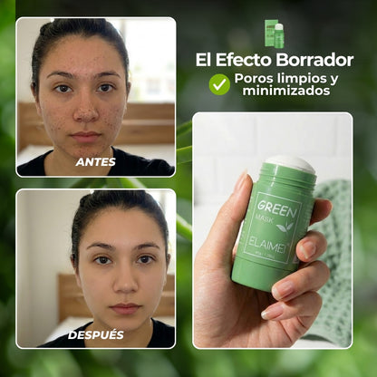 PoroClear™ | Mascarilla Stick que Elimina Puntos Negros (OFERTA 2X1)