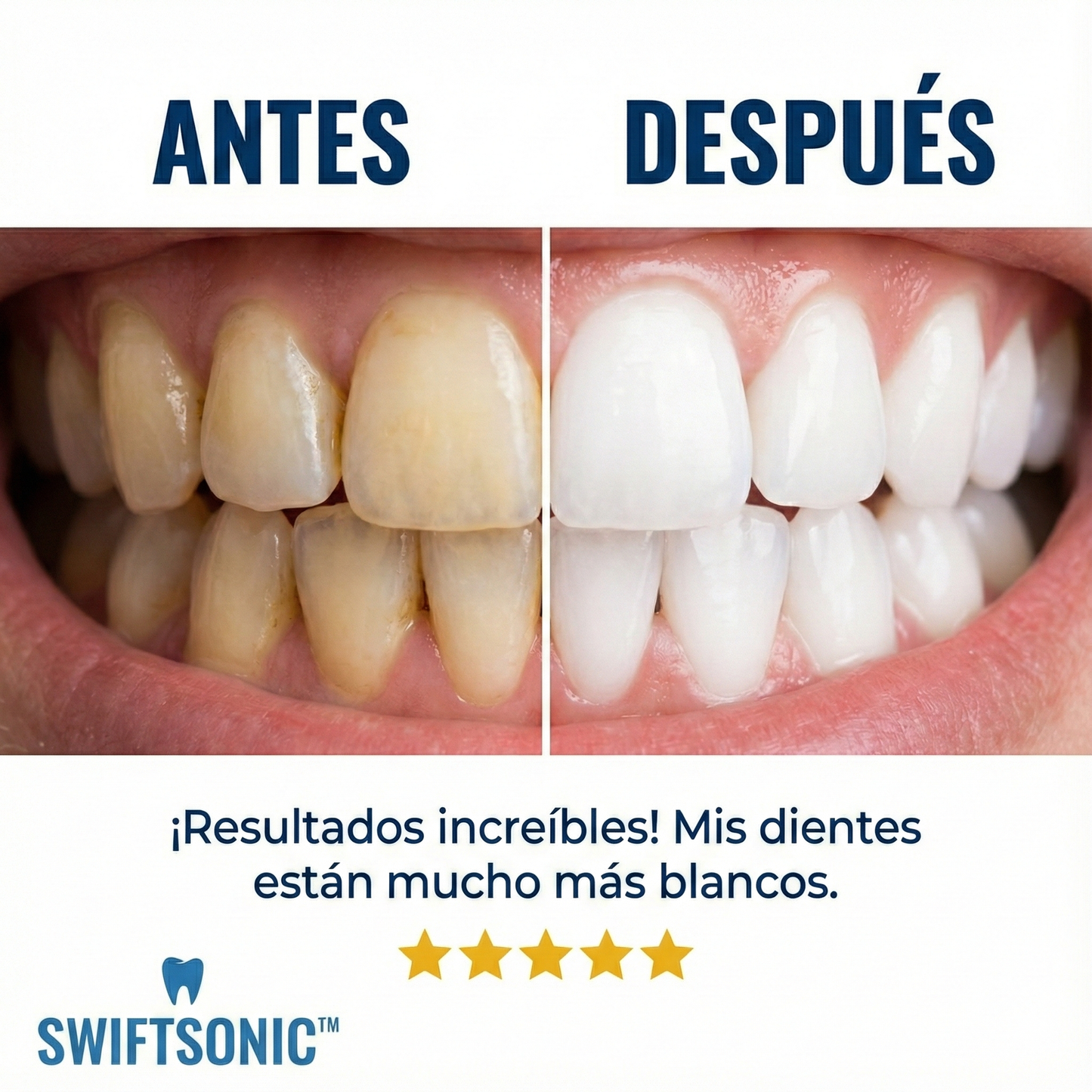 SwiftSonic™ – El cepillo 360º de alta velocidad